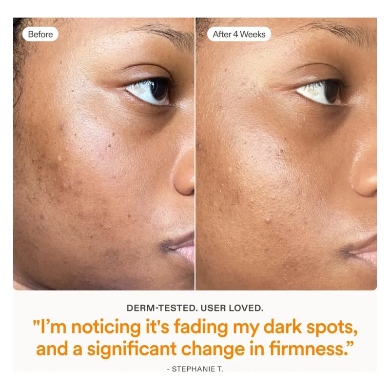 Fix Brighten + Firm 15% Vitamin C Serum For Face