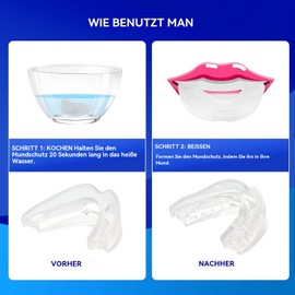 Anti Schnarch Mundstück, Schnarchstopper, Effektiv Aufbissschienen, Beißschiene Nacht Gegen Zähneknirschen und Schnarchen