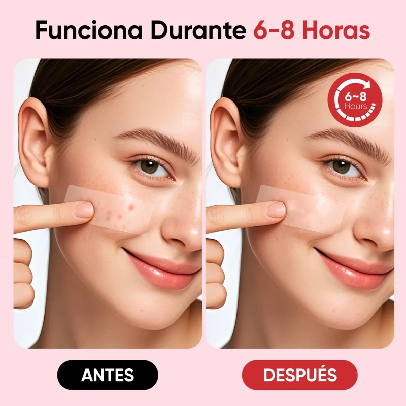 Parches Para El Acné Invisibles, Tamaños Variados Combo