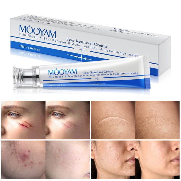 Scar Cream Use on Old and New Scars, Face and Body for Women and Men, Scar Removal Cream, 30g / 1.06 fl oz