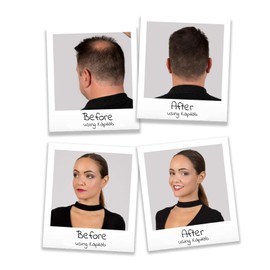 Kapilab Streuhaar Haarfasern Schwarz Haarpuder zur Haarverdichtung - Keratin Ansatzpuder für Dünner Werdendes Haar Frauen und Männer Haarausfall 100% Natürlich 5 gramm