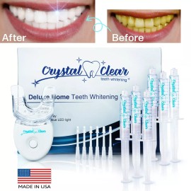 Crystal Clear Kit de láser para blanquear los dientes Gel blanqueador de dientes profesional