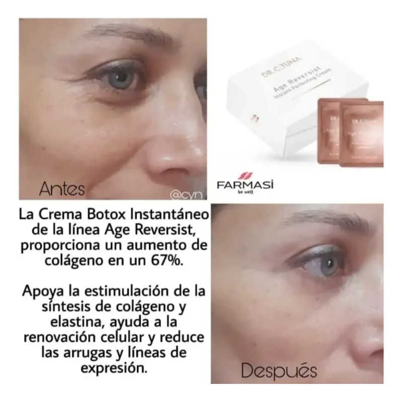 SVR Sebiaclear Active Gel Antiacné 40 ml para Piel Grasa