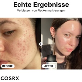 COSRX Niacinamide 15% Face Serum, Reduces Enlarged Pores, Soothes Redness, Corrective Treatment of Discolouration, 20 ml, Not Tested on Animals, Korean Skincare
