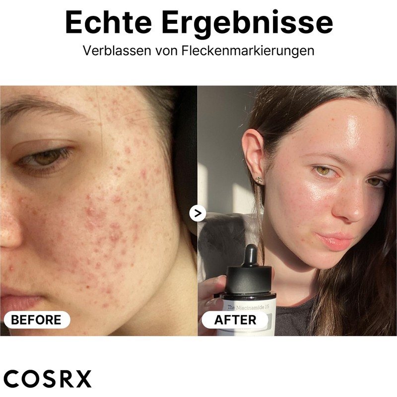 COSRX Niacinamide 15% Face Serum, Reduces Enlarged Pores, Soothes Redness,