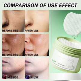 Face Pads - Exfoliator for Acne Prone Skin - Toner & Korean Skincare - Reduces The Growth Of Blackheads(55 pads)