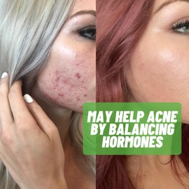 Estrohalt 4 Pack - Diindolylmethane (DIM) and Indole 3 Carbinol (I3C) Supplement for Men & Women - 240 Pills