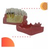 Den Med Modelo Dental Gingivitis