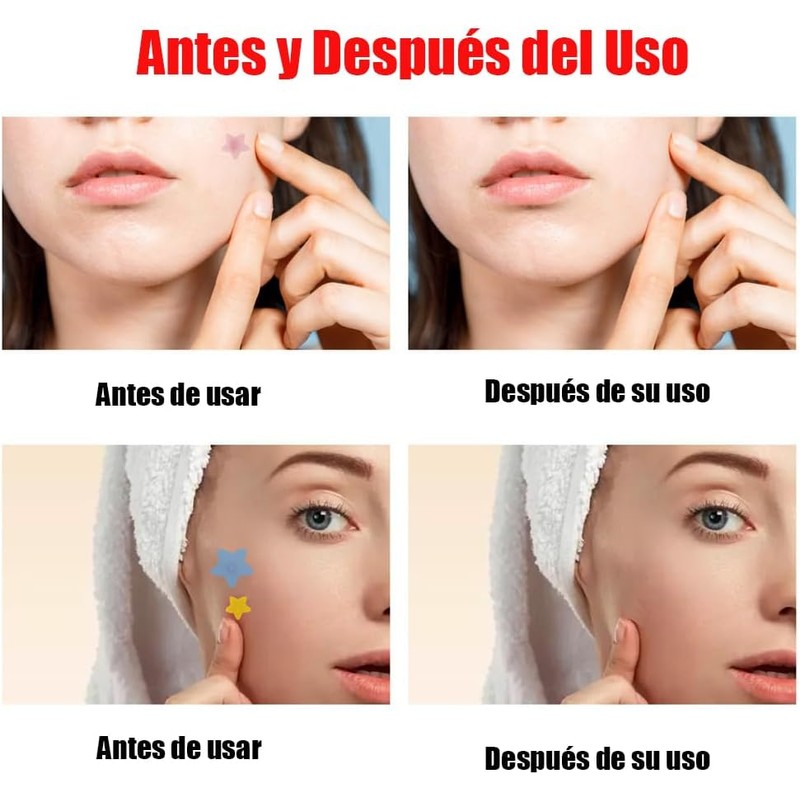 LUHI Parches para Acne, 200 Almohadillas Hidrocoloides para Espinillas, pads