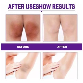 Crema Blanqueadora Despigmentante Zonas Íntimas Labios Ano Original