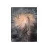 Shampo Sólido Artesanal, Natural Anticaída De Cabello