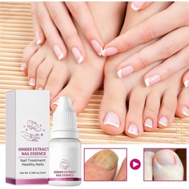 2Pcs Fungigone Nail Treatment, Nail Care Extra Strong Toe, Fungigone Ginger Nail Essence, Nail Repair Growth Treatment Nail Softener for Thick Toenails Toe