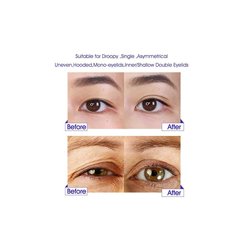 Eyelid Tapes Double Eyelid Sticker - Instant Eye Lid Lift
