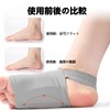 Sellerian Arch Support, Comfortable Flat Foot Support, 1 Foot Support,