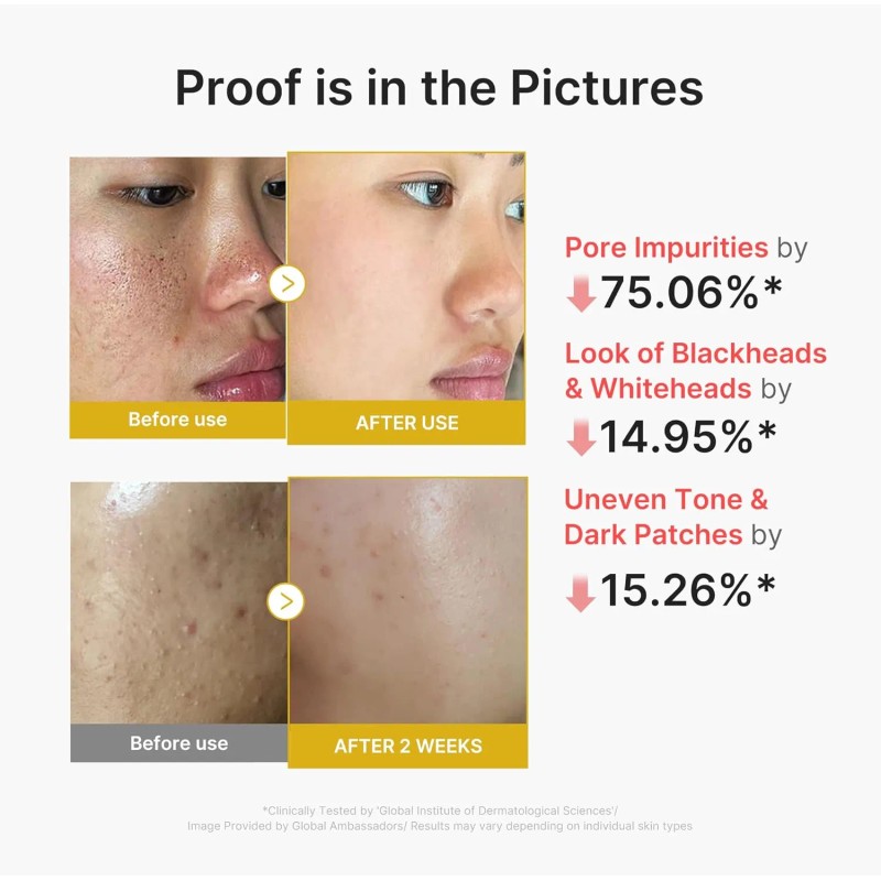 MEDICUBE [MEDICUBE]Kojic Acid Turmeric Peel Shot 80ml