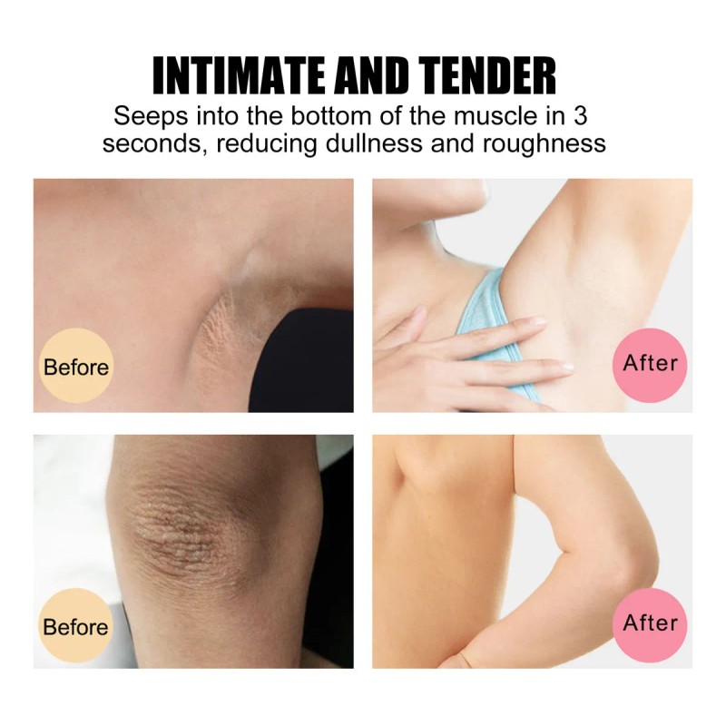 Jabón L Darkspot Whitening, Blanqueador De Axilas, Barra Ava