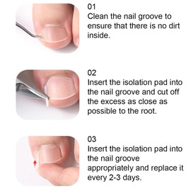 2 boxes/40 Pieces Toenail Correction Strips Brace Kit Clear Ingrown Toenail Corrector Ingrown Toenail Treatment Strips for Ingrown Toenails Foot Care Treatment