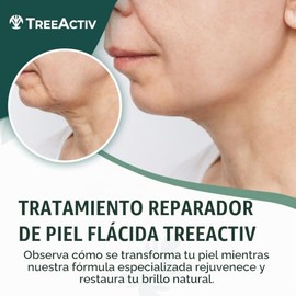 TreeActiv Tratamiento reparador de piel Crepey, fórmula original, 8 fl oz, crema reafirmante para rostro y cuello, loción reafirmante para la piel con