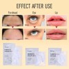 Yeokoe Yeokoe Forehead Wrinkle Patches,Under Eye Patches and Lip Mask