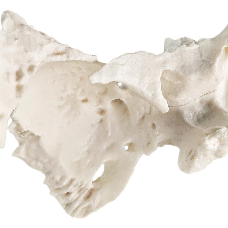 Benilev Human Sphenoid Anatomical Model, Life Size, Presenting Complete Cracks,