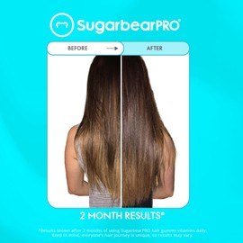 SugarbearPro Sugarbear Hair Vitamin Gummy 6 Month Supply Extra Strength Biotin 6000mcg, Growth for Men & Women, Vegan Vitamin B12, MSM, Inositol, Omega 3, Elderberry, Certified Kosher, Halal, Cruelty-Free