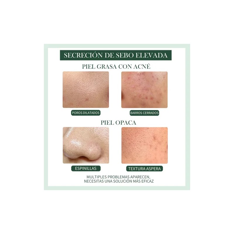Serum Oxyglow Lactic Acid 10% + Ha Para Piel Normal