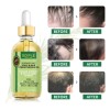 Aceite Para El Crecimiento Del Cabello Wozutunt Rosemary 90