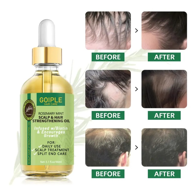 Aceite Para El Crecimiento Del Cabello Wozutunt Rosemary 90