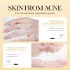 Bioaqua 10 Mascarillas Vitamina E Miel Manuka Aclarante Hidratante