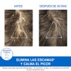 Uriage DS Hair Shampoo para la Caspa Severa con Ácido