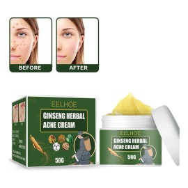 Crema De Tratamiento De Acné Con Ginseng Para Eliminar Las E