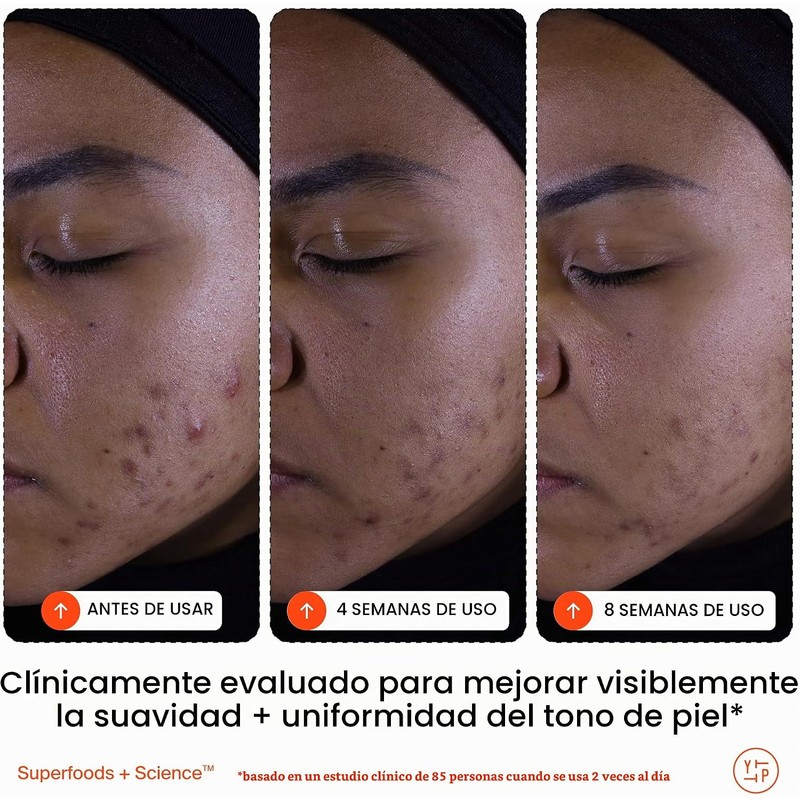 Limpiador Facial Exfoliante Superfruit 145 ml para Iluminar y Suavizar