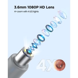 RapterX Digital Otoscope Camera with Light – HD Screen 90° Foldable Support Photo Video and PC View, Ear Infection Detector, Pocket Ear Scope with Earwax Removal Tool for Family Adults, Kids and Pets