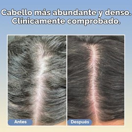 Suero para dar densidad al cabello con tripeptidos Boost Therapy. Para un cabello más grueso y abundante. Tratamiento ligero para el cuero cabelludo c