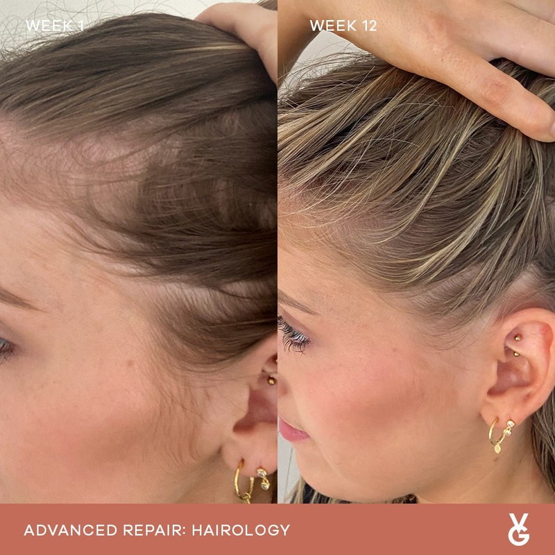 Vida Glow Hairology Advanced Repair - 30 Capsules