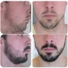 Crecer Barba Bigote Cejas Profesional Y Natural Total