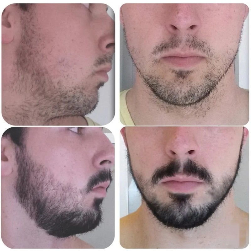 Crecer Barba Bigote Cejas Profesional Y Natural Total