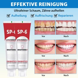 SP-6 Probiotische Whitening Zahnpasta, 2pcs Intense Whitening Zahnpasta, 6 Probiotika für Zahnaufhellung, frischen Atem, fluoridfrei, Gesundes Zahnfleisch, Für Empfindliche Zähne (140g*2)