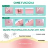 ACOTYE Pimple Plasters (DO01-245pcs, S)