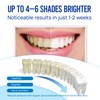 VieBeauti Teeth Whitening Pen