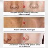 Rorec Serum Arroz Rorec Original P/cerrar Poros + Aclarante Facial