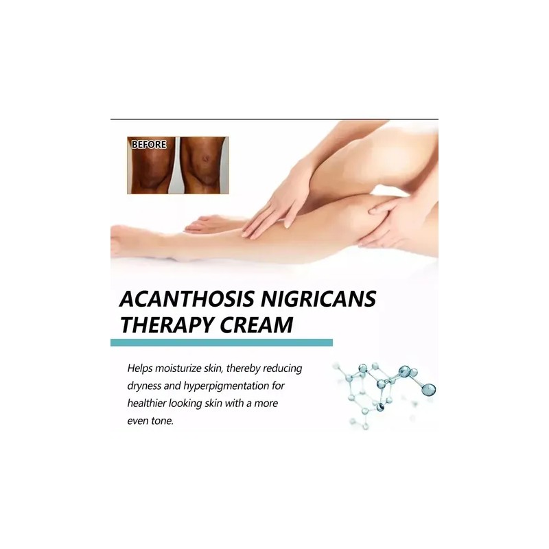 Fixderma Nigrifix Crema Para Acantosis Nigricans Fbgx2