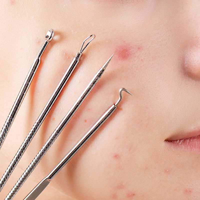 Comedone Squeezer, Pack of 2 Comodone Remover, Pimple Needle, Needle