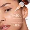 Vichy Liftactiv Sérum Vitamina C Efecto Antioxidante y Luminosidad, 20