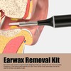 Earwax Removal Kit Intelligent Visible Support APP Ear Cleaner with