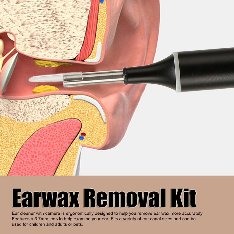 Earwax Removal Kit Intelligent Visible Support APP Ear Cleaner with