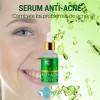 BENA Belleza natural Serum Facial Antiacne + Acido Hialuronico Piel