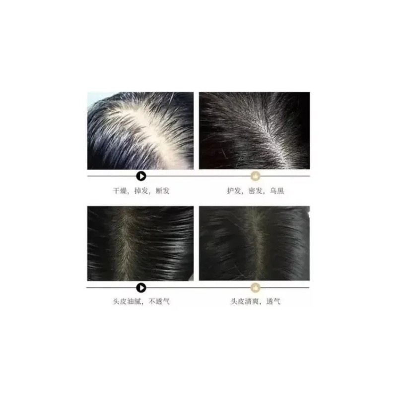 2 Shampoo Reparador Romero Anticaída Crecimiento