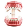Dentalmall Dental Model Brushing Flossing Practice Teeth Typodonts Mode Gingiva