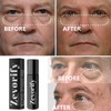 Zevorify Zevorify Eye Repair Stick for Men | Caffeine Under